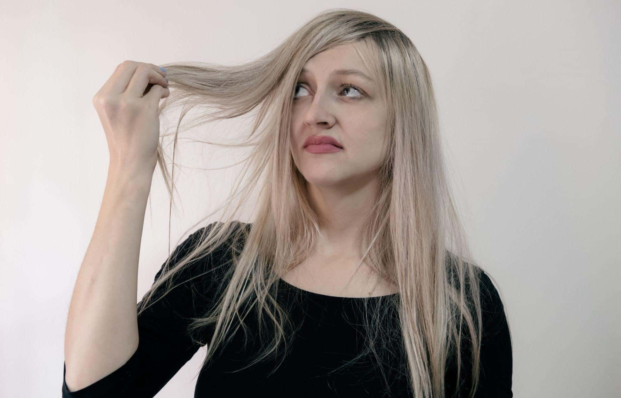 5 Effective Ways To Get Rid Of The Dandruff