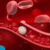 Anemia