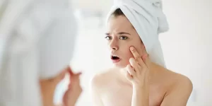 Ayurvedic Treatment For Pigmentation On The Face