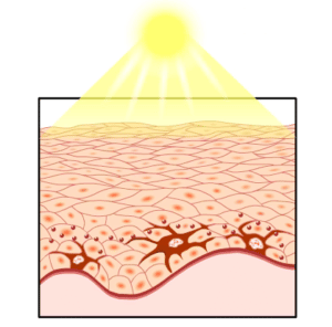 Ayurvedic Treatment For Pigmentation On The Face