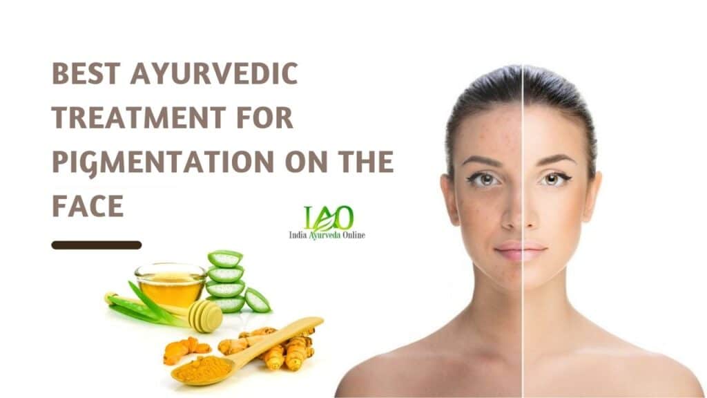 Best Ayurvedic Treatment For Pigmentation On The Face